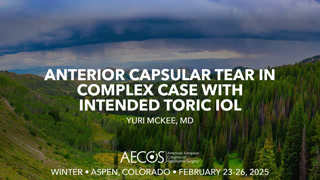 Anterior capsular tear in complex case with intended toric IOL